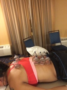 Gametime Acupuncture performing cupping on elite NYC Old Blue Rugby Championship athlete (1)
