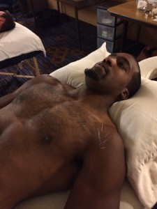 Gametime acupuncture working with therapeutic needles 4 - Marriott Hotel - Stapleton, Colorado