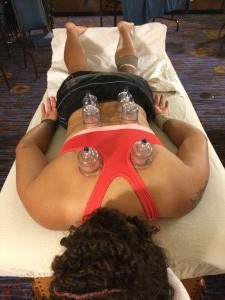 NYC Old Blue Rugby Championship athlete receives cupping during treatment session at hotel (1)